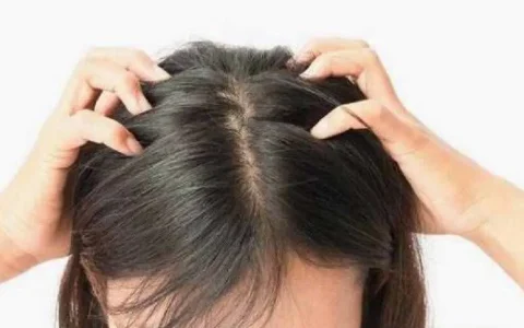 天天洗头发有什么危害，如何改善油性头发
