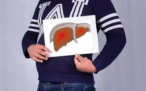 乙肝有什么症状吗,乙肝有什么症状吗男人