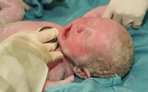这位41岁的女性在痛苦中生下了一个男宝20多个小时，但被推出来的不是母亲。