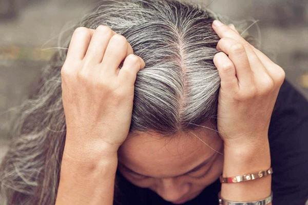 白头发要怎么改善 白头发要怎么预防