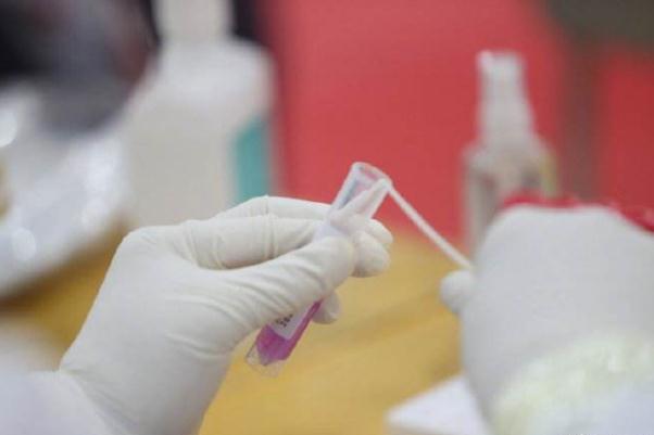 山西太原发现1高中生阳性 核酸检测对潜伏期有用吗