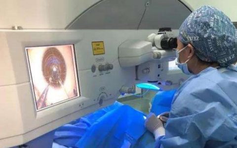 icl晶体植入术和激光手术怎么选择(icl晶体植入手术后眼底能打激光吗)