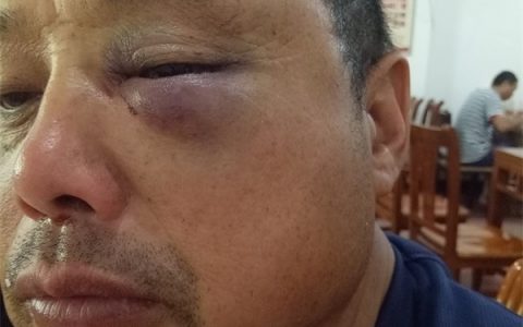 5年5次起诉离婚女子父亲遭前夫殴打 该事件始末详情曝光！