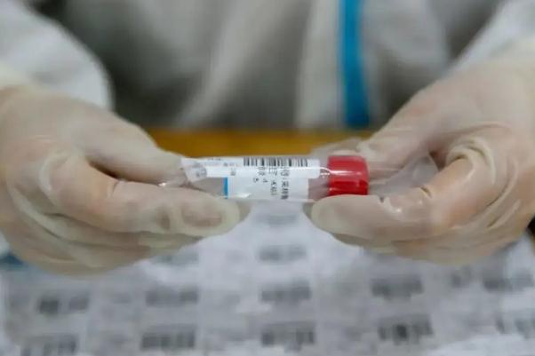 核酸单人单检降至不高于28元 做核酸检测是免费还是自费