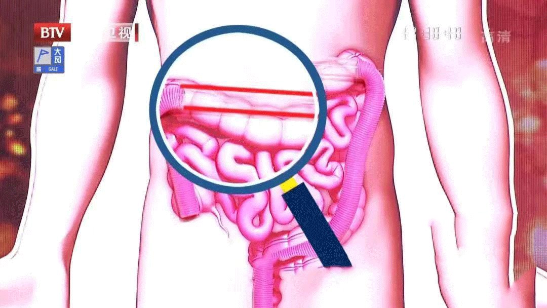 随访22年研究：长期吃蒜，能降低胃癌死亡率！但怎么吃、吃多少，都有讲究，可别吃错