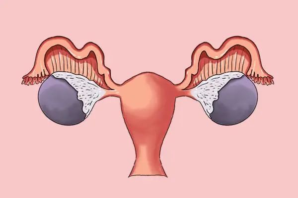 女性体毛多，与什么有关？