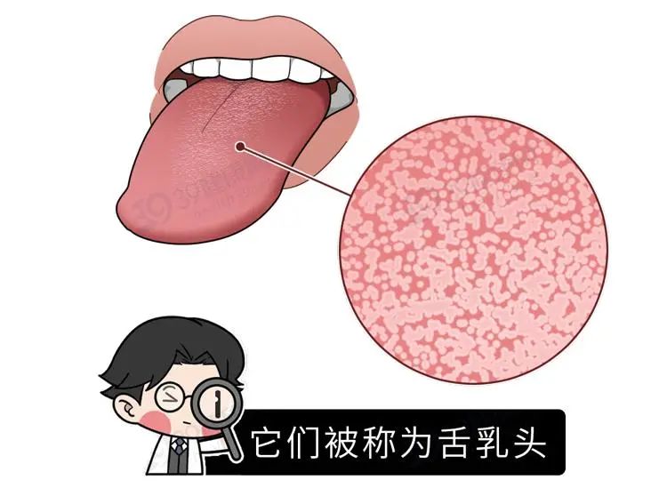 小舌头乳头状瘤图片