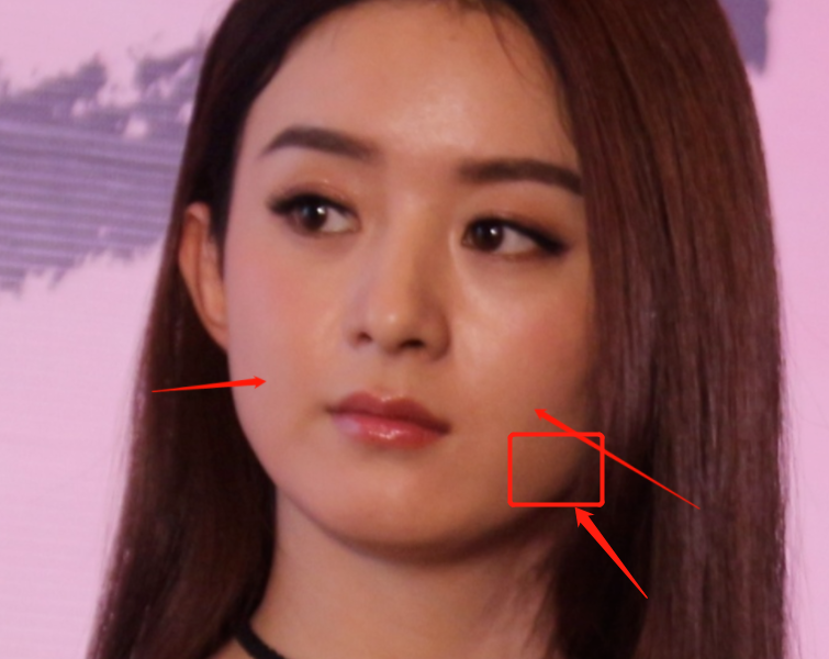 赵丽颖破除整容传闻，新剧预告厚唇没了，山根回凹脸还是有点方
