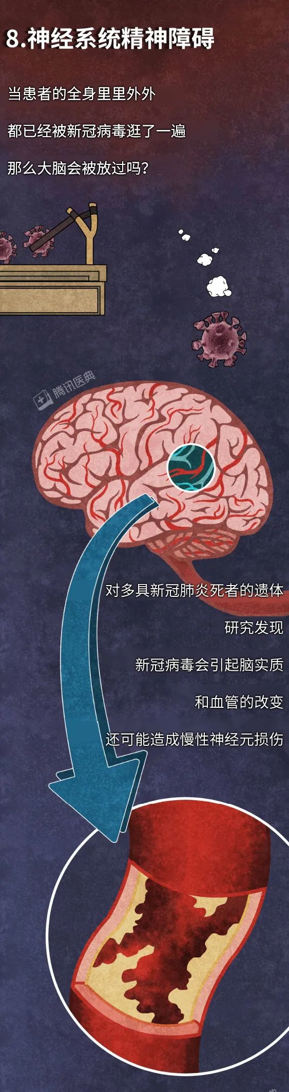 最早感染新冠病毒的人，后来怎么样了？