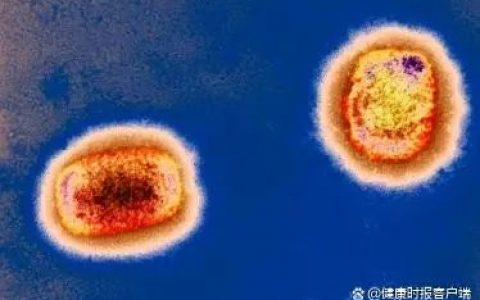 猴痘和天花是“近亲”？中国：天花消灭后疫苗已封存。