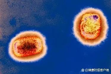 猴痘与天花是“近亲”？中国生物：已在消灭天花后，对牛痘进行了封存