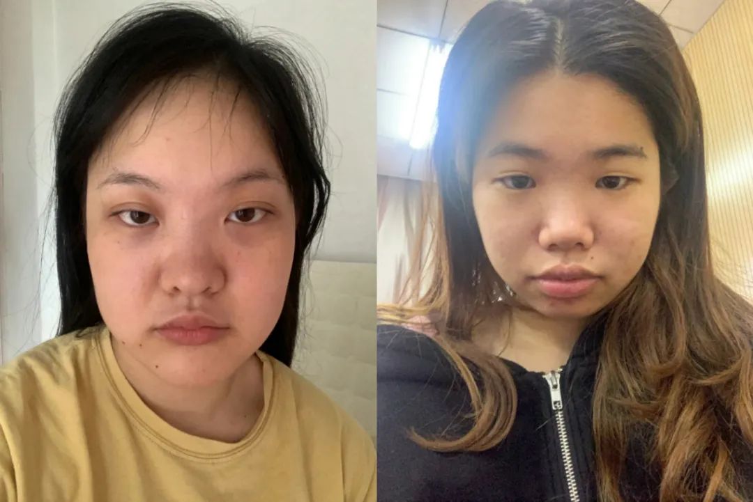 为什么“扁平脸”的女生，更受直男欢迎？