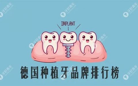 德国camlog种植牙怎么样，德国种植牙牙冠品牌
