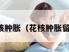 花核肿胀（花核肿胀留水）